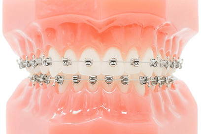 Kieferorthopaedie-Orthodontie-Geneve-MC20-Johannes-Jamin-SPEED